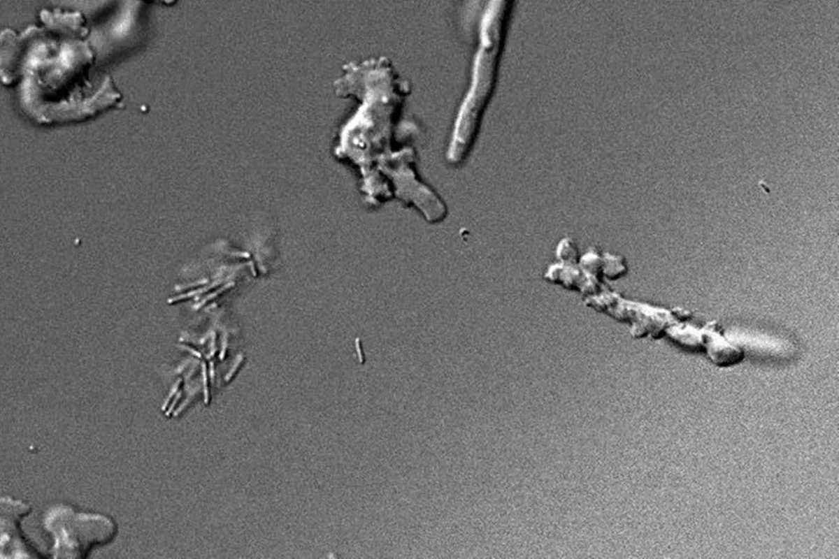 Nova ameba se reproduz a 63 ºC em lago vulcânico nos Estados Unidos