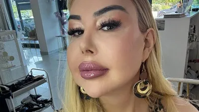 Patrícia Ribeiro relata primeiro orgasmo após cirurgia de redesignação sexual